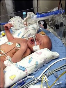 Click image for larger version

Name:	Easton with oxygen tube.jpg
Views:	613
Size:	19.3 KB
ID:	7187