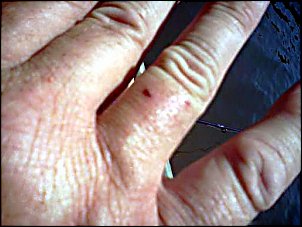 Click image for larger version

Name:	impaled hand.jpg
Views:	412
Size:	37.5 KB
ID:	8134